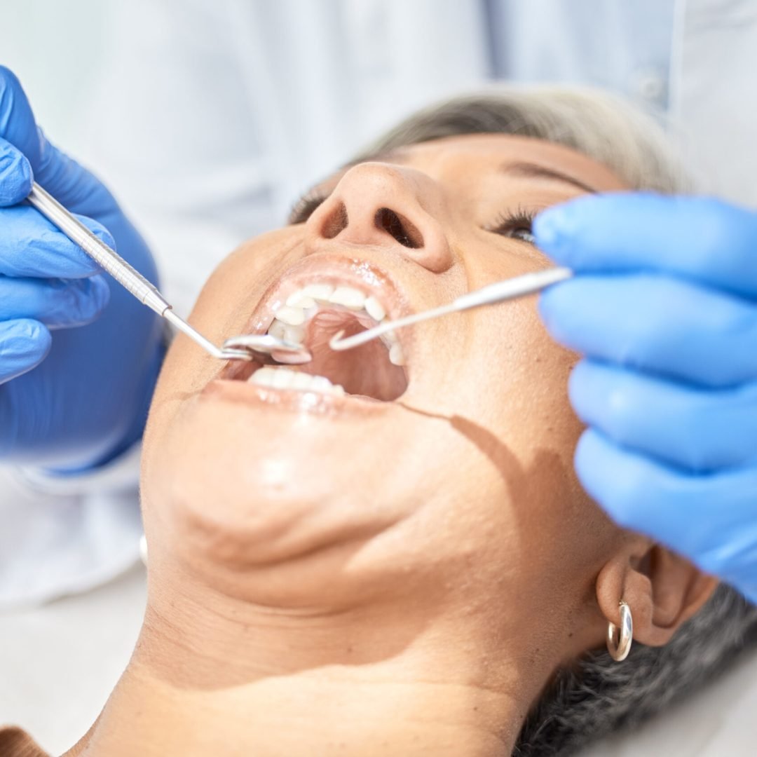 woman-mouth-and-dentist-hands-with-tools-medical-2025-04-06-08-18-43-utc Woman, mouth and dentist hands with tools, medical and dental procedure, healthcare and closeup. Or.